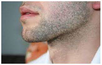 Stubble - The very short hairs on someone's skin when they have not shaved recently,
