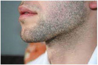 Stubble - The very short hairs on someone's skin when they have not shaved recently,