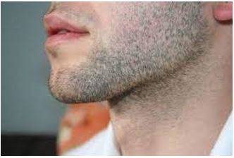 Stubble - The very short hairs on someone's skin when they have not shaved recently.