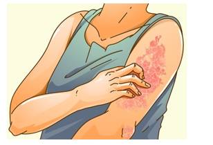 Excoriate - To criticize severely or denounce strongly; to strip off or damage the skin.